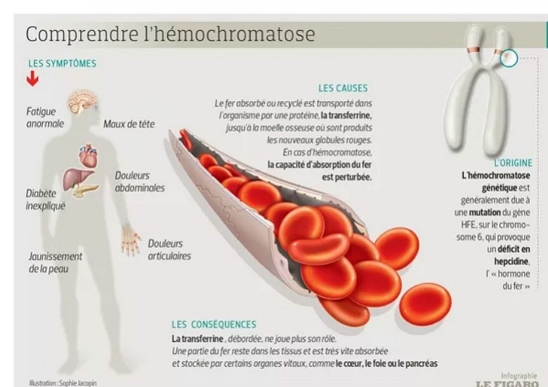 Hyperferritinemie - h&eacute;mochromatose