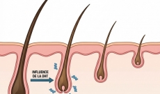 Alop&eacute;cie et chute de cheveux : Comprendre la DHT pour mieux agir